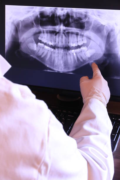 Best Emergency Treatment for Dental Infections or Abscesses in Kiawah Island, SC